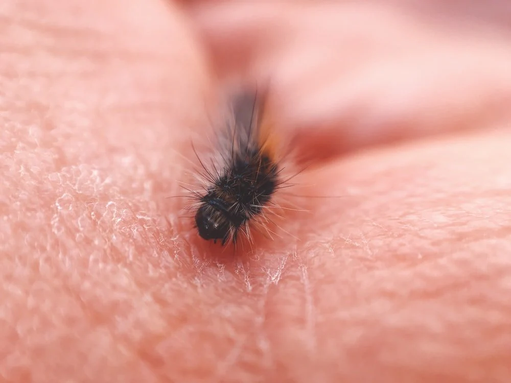 Paint By Numbers | Flea - Black Insect On Human Skin